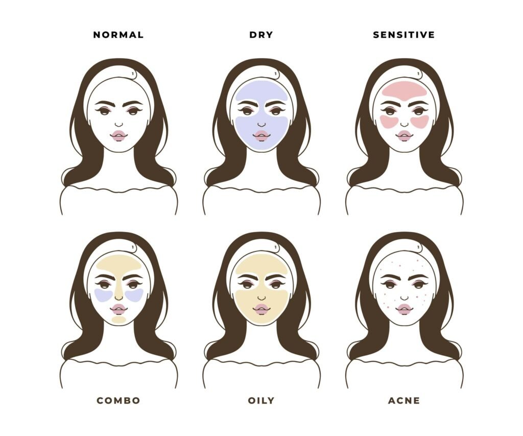 Skin types