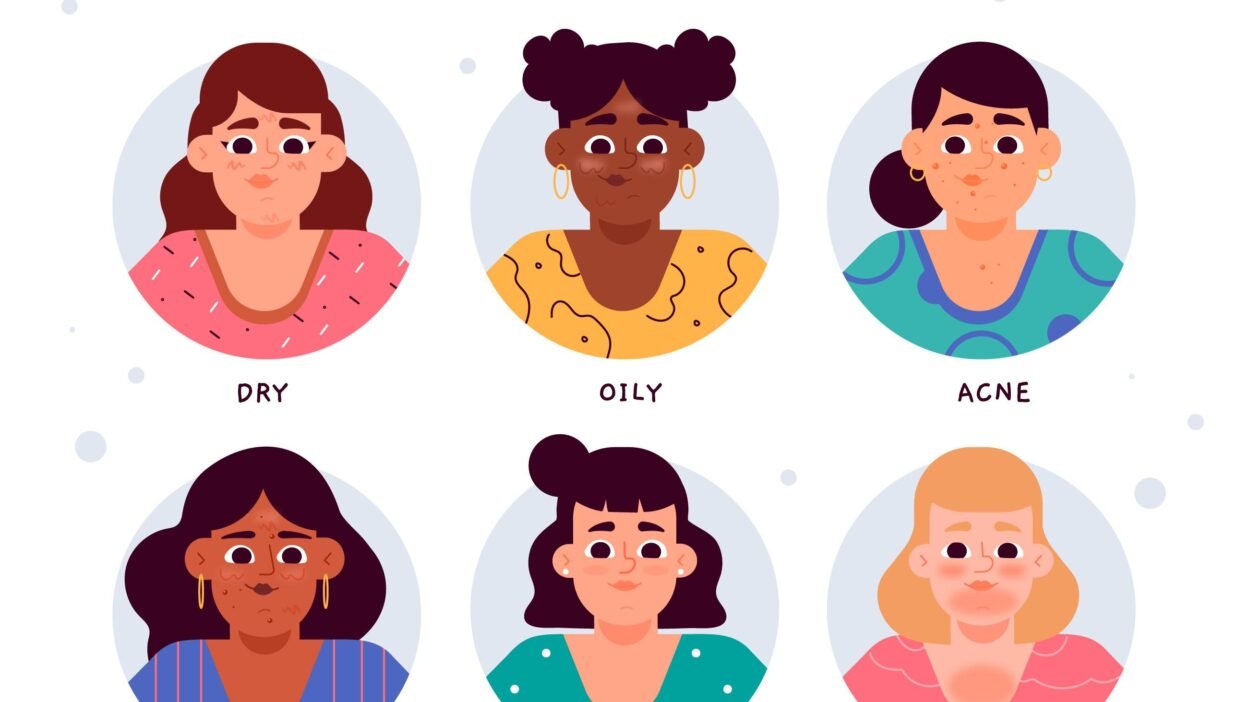 skin types